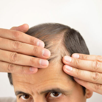 11 Lifestyle Changes to Help Reduce Hair Loss